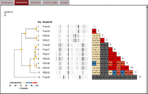 DiversiLab® Software